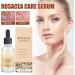 Rosacea Face Serum Face Serum Hyaluronic Acid Face Oil Anti-Aging Relieve Redness &Quick Repair Damage Skin Niacinamide Serum Replumps & Hydrates Collagen Face Serum-Protect Skin+Reduce Acne-Women 1 - Buy Online on GoSupps.com
