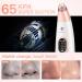 Blackhead Remover Vacuum - USB Pore Cleaner Tool for Men and Women | 3 Modes & 6 Suction Heads - Pink - Buy Online on GoSupps.com