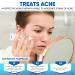 AOBBIY Azelaic Acid Cream: Azelaic Acid For Face - Premium Azelaic Acid Cream - Face Skin and Beauty Care - Azelaic Acid Facial Cream (1 Oz) - Buy Online on GoSupps.com