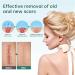 CRusio Awzlove Ampoule Scar Removal Serum - Remove New Scars in 3 Weeks, Old Scars in 6 Weeks (1pcs) - Buy Online on GoSupps.com