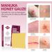 Manuka Honey Gauze Dressing 2x2 | Medical Grade Honey Patches for Wound Care | Pack of 10 for Faster Healing - Buy Online on GoSupps.com