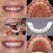 Dental prosthesis cosmetics immediate false teeth silicone at the top and bottom for women and men removable natural temporary tooth facets to brighten the teeth