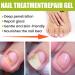 Narc Lot de 2 gels de r paration pour ongles Paronychia gel r parateur pour ongles et ongles ab m s 2Pcs - Buy Online on GoSupps.com