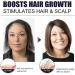 Ginger Hair Growth Mist Hair Growth Serum Herbal Mist for Hair Regrowth Natural Nourishing Scalp Mist for Hair Loss - Buy Online on GoSupps.com