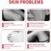 Charbon Active Peau Blanchiment et exfoliant visage Nettoyer en profondeur les pores de la peau Hydrater et raffermir la peau Blanchiment Nettoyage en profondeur des pores et de la (Pink One Size) Rose 56 g (Lot de 1) - Buy Online on GoSupps.com