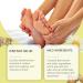 Bee Venom Bunion Relief Cream Bunion Relief Rub Bunion Relief Balm Bunion Cream Bunion Gout Cream Toe and Knee Joint Cream Healing Cream for Aching Bunions & Dry Cracked Skin(1pcs) - Buy Online on GoSupps.com