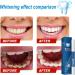 Teeth Whitening Pens - 2 Pack Painless Travel-Friendly Stain Remover Gel - Buy Online on GoSupps.com