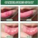 2pcs Mouth Ulcer Spray Mouth Ulcer Treatment Spray Canker Relief Spray Oral Ulcer Sprays Herbal Mouth Spray to Reduce Bad Breath Canker Sore Treatment Ulcer Breath Sprays Mouth Freshener Spray - Buy Online on GoSupps.com