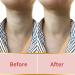 Silicone Anti-Wrinkle Pads for Neck - Overnight Hydrating Comfort for Youthful Skin - Buy Online on GoSupps.com