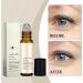 Anti Dark Circles Under Eye Oil Castor Oil Roll On Dark Circles Under Eye Roller Eye Essences for Concealer and Light Fine 2 - Buy Online on GoSupps.com