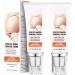 scar removal cream, scar care cream, scar treatment gel, scar removal cream for surgical scars, acne scars, cesarean section