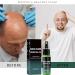 Bald Scalp Care | 20ML Soothing Natural Liquid Scalp Moisturizer | for Follicles Tension and Irritation. Suitable for Men Dads Colleagues and Girlfriends - Buy Online on GoSupps.com