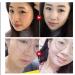 Huangfutang Herbal Formula Skin Cleanup Ointment Cream - 2 Pcs - Buy Online on GoSupps.com
