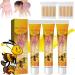 WOSLXM Bee Venom Psoriasis Treatment Cream New Zealand Bee Venom Professional Psoriasis Treatment Cream Soothing and Moisturizing Psoriasis Cream for All Skin Types (3PCS)