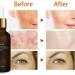 Inblair Rejuvenating Facial Serum Rejuvenating Facial Serum Suitable for All Skin Types 3pcs - Buy Online on GoSupps.com