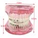 Buy Dental Orthodontic Teeth Model with Metal & Ceramic Brackets - Ideal for Study & Research | International Shipping Available - Buy Online on GoSupps.com