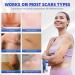 Scar Cream Silicone Gel for Old and New Scars - Advanced Formula for Keloids, Surgery, Acne - 1.5 OZ - Visible Results - All Skin Types - Buy Online on GoSupps.com
