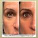 Droplette Collagen Hydrofiller Refill Capsules - Rejuvenate Hydrate & Plump Skin - Vitamin C Argireline & Turmeric - 30 Count for All Skin Types - Buy Online on GoSupps.com