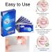 iZhuoKe Professional Teeth Whitening Strips - 28 Pieces for Teeth Stain Removal and Whiter Teeth - Buy Online on GoSupps.com