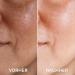 VITAYES Vitamin C Face Serum - Anti-Aging Hydrating Serum with Hyaluronic Acid for Dark Spots Fine Lines & Wrinkles - 1 Oz - Buy Online on GoSupps.com
