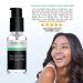 Yeouth Glycolic Acid 30% Gel Peel - Exfoliating Facial Peel | 2 fl oz (60 ml) - Buy Online on GoSupps.com