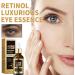 Retinol Eye Serum for Dark Circles & Puffy Eyes - Anti-Aging Cream to Reduce Wrinkles & Hydrate Skin - Suitable for All Skin Types - Buy Online on GoSupps.com