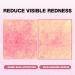 Physiogel Red Soothing Essence Reduces Redness Hydration for Dry & Sensitive Skin Fragrance-Free Non-Comedogenic Dermatologist-Tested Lightweight - Buy Online on GoSupps.com