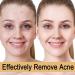 Glycolic Acid 7% Toning Resurfacing Solution - Glycolic Sour 7% Toner - Hydrating Toning Solution - Skincare Hyaluronic Acid Serum - for Blemishes and Acne Prevents Skin Aging Strengthen Your Skin - Buy Online on GoSupps.com