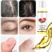 Castor Oil Cold Pressed Natural Vegan & Pure 100ML Castor Oil for Hair Eyebrows & Eyelash Growth Softer Skin & Face Organic Castor Oil Diminishes Wrinkles and Signs of Aging - Buy Online on GoSupps.com
