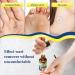 Maximum Strength Wart Remover with Salicylic Acid - Fast-Acting Treatment for Plantar Common & Flat Warts - Safe for Children & Adults - 30ml - Buy Online on GoSupps.com