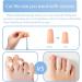 Toe Supporters Silicone Gel Toe Caps - Breathable Beige Toe Protectors for Pain Relief | 14-Pack for Corns & Ingrown Toenails - Perfect for Men & Women - Buy Online on GoSupps.com