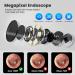 1296p HD WIFI Ear Wax Removal Otoscope | LED Camera Ear Cleaner for iPhone iPad & Android - Safe & Effective Cleaning - Buy Online on GoSupps.com