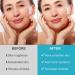 Forehead Face Wrinkle Patches - 256 Silicone Skincare Pads for Smoothing Frown Lines & Reducing Fine Lines Overnight - Buy Online on GoSupps.com