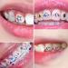 Shop Stylish DIY Tooth Jewelry Set | Colorful Rhinestone Tartar & Crystal Glue International Shipping Available - Buy Online on GoSupps.com