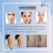 Scar Removal & Acne Cream | All-Natural Healing for Scars Spots & Pimples 1.7 fl oz - Buy Online on GoSupps.com