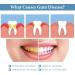 wimony Neslemy Gum Shield Therapy Gel Dentizen Gum Therapy Gel Gum Repair Treatment Gel Instant Teeth Whitening Essence Pen Deeply Cleaning Gums Teeth Whitening Enhances Overall Gum Health (4pcs) - Buy Online on GoSupps.com