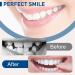 2 PCS Dental Veneers for Temporary Tooth Repair - Natural Shade Fake Teeth for Women and Men | Enhance Confidence and Protect Teeth - Buy Online on GoSupps.com