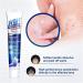 Wart Removal Body Warts Treatment Cream Foot Care Cream Skin Tag Remover Instant Blemish Removal Gel Body Treatment Ointment Without Leaving Scars and Refuse to Repeat (3Pcs) - Buy Online on GoSupps.com