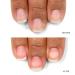 LONDONTOWN kur Nail Probiotic Instant Boost Nail Mask - Clear (25112) - Buy Online on GoSupps.com