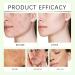 Hydrating Face Serum - Gentle Formula Balances Skin Microbiome Dual-Molecular Lock Moisture Easy Use For Daily & Pre-Makeup(1PCS) - Buy Online on GoSupps.com