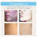 Amaira Advanced Scar Vanishing Cream - Natural Marine Botanical Formula for Blemishes Scarring & Stretch Marks - Perfect for Sensitive Skin - 1oz Tube - Buy Online on GoSupps.com