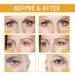 Rice Eye Cream For Dark Circles And Puffy Eyes Rice Eye Cream Anti Aging Eye Cream With Natural Rice Extract Brightens Under Eye Diminishing Deep Wrinkles Suitable For All Skin Types - Buy Online on GoSupps.com