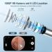 Outact 1080p HD Ear Wax Removal Otoscope - Waterproof Ear Cleaner with 6 LEDS & 6 Ear Spoons for iPhone iPad & Android - Buy Online on GoSupps.com