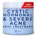 Cystic, Hormonal & Severe Acne Spot Treatment, Natural Pimple Cream with Salicylic Acid & Tea Tree for Teens & Adults, Zit, Milia, & Blemish Minimizer for a Clean Face & Body, 150+ Treatments by Ayadara