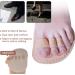 Paris Big Toes Ballenzeh Protector Pads - Thumb Toe Straightener & Separator for Crooked Toes Hammer Toe Pain Relief & Hallux Valgus Correction - Buy Online on GoSupps.com