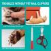 Cobee Cat Nail Clippers Professional Claw Trimmer Scissor + Pet Nail File for Cats Kittens Stainless Steel Cat Claw Clippers Scissors Trimmer Set for Small Animals Puppies Hamsters Birds(Black+Red) - Buy Online on GoSupps.com