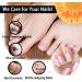 CAOQAO Nail Fix Solution Thickened Bright Nails To Get Rid Of Nail Dead Skin Fix Moisturizing Nail Nutrition Care Solution 30ml Nail Suction (B One Size) 1 count (Pack of 1) B - Buy Online on GoSupps.com