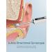 Qimic Wireless Ear Wax Remover 1080P FHD Camera Kit - Visual Otoscope for Adults, Kids & Pets (White) - Buy Online on GoSupps.com
