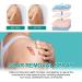 3Pcs Medical Grade Scar Remove Spray - Advanced Acne Scar Treatment - Buy Online on GoSupps.com