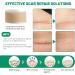 3 Rolls Silicone Scar Sheets(1.6" x 60" Each) Silicone Patches for Scars Reusable Scar Removal Strips for Prevention and Repair - Buy Online on GoSupps.com